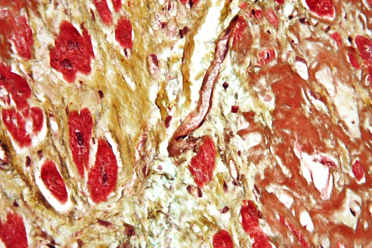 Les defis majeurs des maladies cardiovasculaires et la prevention mondiale